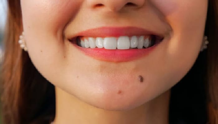 Meaning of Mole