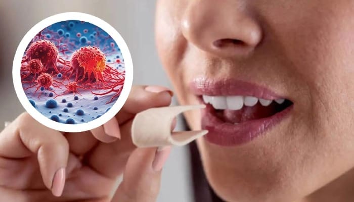 Anti Virus Chewing Gum