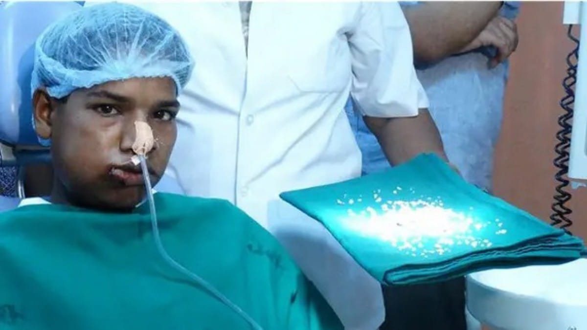 Rare Dental Surgery India
