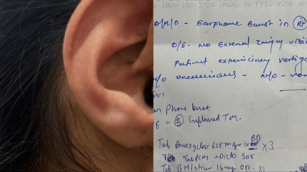 Earphone Exploded in Ear